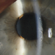 Image for article titled The Ebola Virus Can Live Inside Your Eyes
